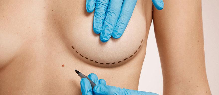 augmentation-mammaire-tunisie augmentation mammaire tunisie