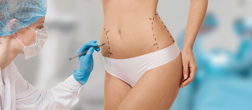 liposuccion-tunisie-mvs liposuccion tunisie