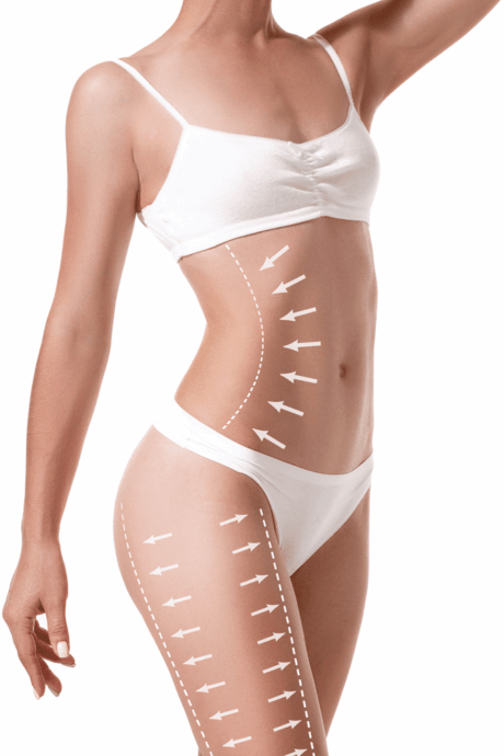 liposuccion-tunisie-esthetique liposuccion tunisie